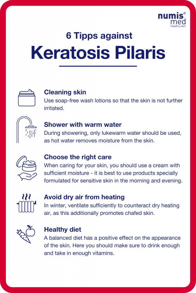 tipps_against_keratosis_pilaris